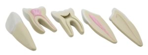 GD0311 Serie di denti
